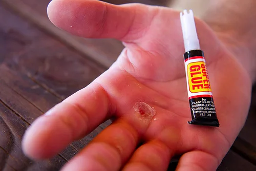 super glue. alert1 medical alert systems